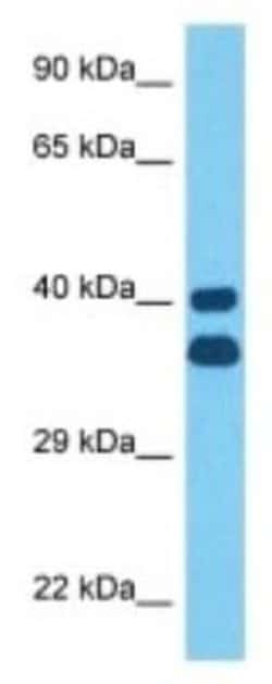Otx1 Rabbit anti-Mouse, Polyclonal, Novus Biologicals 100 &mu;g; Unconjugated:Antibodies,